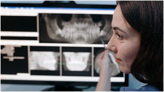 What Is Jawbone Loss?