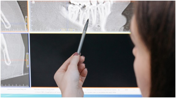 The Domino Effect: How Bone Loss Changes Your Face